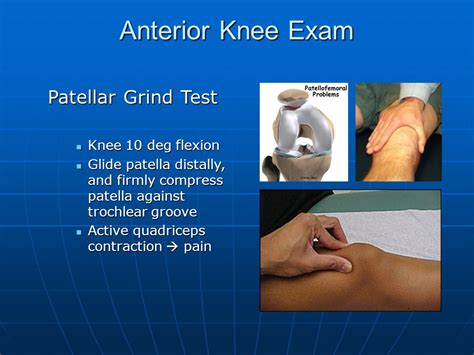 is patellar compression test|patellar grind test positive.